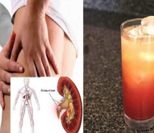 გემრიელი და სასარგებლო სასმელი თირკმელებში კენჭების წინააღმდეგ. ეფექტურია