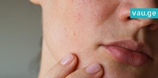 ინგრედიენტი, რომელიც სახის ღია ფორებს შველის. ყველაზე ეფექტური მეთოდი