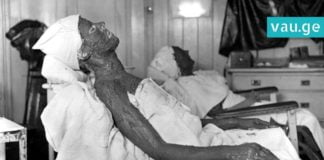 წარსულის კოსმეტოლოგია, ანუ სილამაზე მსხვერპლს მოითხოვს. საინტერესო ფოტოების კრებული