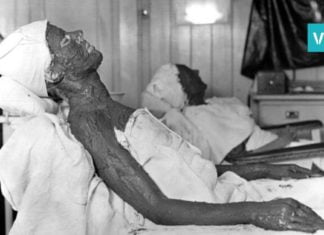 წარსულის კოსმეტოლოგია, ანუ სილამაზე მსხვერპლს მოითხოვს. საინტერესო ფოტოების კრებული