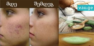 აკნესგან გათავისუფლების საუკეთესო ხერხი. ეს თქვენს კანს უფრო რბილს და გლუვს გახდის