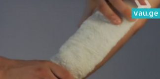 როგორ ვუმკურნალოთ სუროსგან მოწამლულ ადგილებს სხეულზე – ეს ხერხი ყველამ უნდა იცოდეს