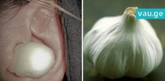 მან ნიორი ყურში ჩაიდო! მიზეზის გაგებამ კი ავადმყოფობას გადამარჩინა, ამას არ ველოდი…