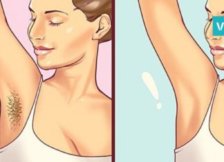 წყალბადის ზეჟანგი, რომელიც არასასურველი თმის მოშორებაში დაგეხმარებათ! იაფი და ეფექტურია