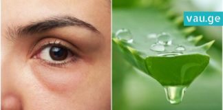 აღიდგინე მხედველობა ალოეს დახმარებით! ხალხური საშუალება ცნობილი ოფთალმოლოგისგან