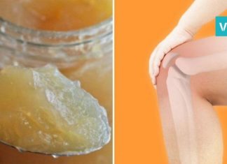 სახსრების ტკივილის საწინააღმდეგო რეცეპტი. ხერხი, რომელიც ბევრმა ადამიანმა სცადა