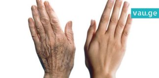 დაგღალათ ხელებზე ნაოჭებმა და პიგმენტურმა ლაქებმა? ეს რეცეპტი საბოლოოდ გააქრობს მათ