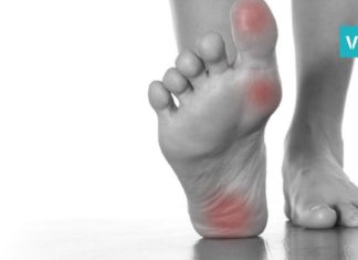 როგორ ვუმკურნალოთ კოჟრებს? 4 ყველაზე ეფექტური ხერხი, რომელიც კანს სწრაფად არბილებს