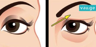 როგორ ვუშველოთ ჩამოწელილ ქუთუთოს! ნეტავ, აქამდე მცოდნოდა…