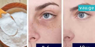 მან სოდა თვალების ქვემოთ წაისვა და რამდენიმე წუთში… ყველა ქალი ასე მოიქცევა