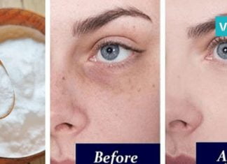 მან სოდა თვალების ქვემოთ წაისვა და რამდენიმე წუთში… ყველა ქალი ასე მოიქცევა