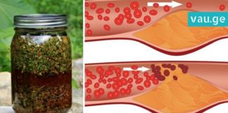 კამა, თაფლი და ვალერიანი-მოამზადეთ საუკეთესო საშუალება სისხლძარღვებისთვის!