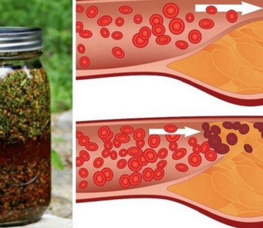 კამა, თაფლი და ვალერიანი-მოამზადეთ საუკეთესო საშუალება სისხლძარღვებისთვის!