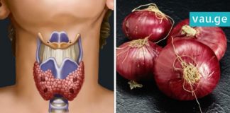 მან ხახვის კომპრესი ყელზე დაიდო… ის, რაც შედეგად მიიღო საოცარია!