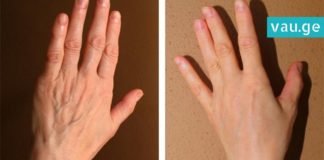 ეს სუპერმაზი თქვენს ხელებს გაახალგაზრდავებს! ეფექტური საშუალებაა…