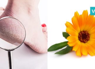 კრემი დახეთქილი ფეხის ქუსლებისთვის! მსგავს კრემს მაღაზიაში ვერ იშოვით!