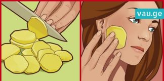 ის სახეზე უმ კარტოფილს ისვამდა, შედეგი სასწაულია… აუცილებლად უნდა ვცადო!