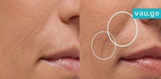 როგორ უნდა მოიშოროთ სახიდან ეს ხაზები? საუკეთესო საშუალებაა