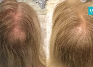 ამ ხრიკის დახმარებით თმა სწრაფად გაიზრდება – ეფექტურობაში თავად დარწმუნდებით!