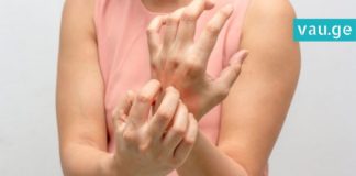 აი, რა უნდა იცოდეთ ფსორიაზზე-სასარგებლო რჩევები თქვენთვის!