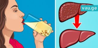 აი, როგორ უნდა გაისუფთაოთ ღვიძლი ქიშმიშით2 დღეში -ეფექტური მეთოდი!