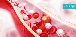 ამ სასმელს ექიმები მაღალი ქოლესტერინის მქონდე პაციენტებს ურჩევენ! ის ცხიმებსაც წვავს!