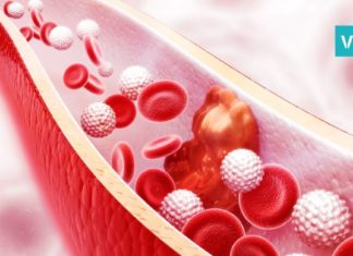 ამ სასმელს ექიმები მაღალი ქოლესტერინის მქონდე პაციენტებს ურჩევენ! ის ცხიმებსაც წვავს!