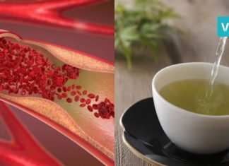 ხალხური საშუალება სისხლძარღვების გასაწმენდად! ამიერიდან ათეროსკლეროზს დაივიწყებთ!