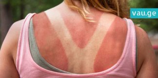 მზისგან დამწვრობის ლოსიონი, რომელიც დაგიმშვიდებთ კანს! 2 ინგრედიენტია მარტო საჭირო!