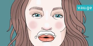 როგორ მოვიშოროთ ტუჩზედა თმა? ეს რეცეპტი ნატურალური და უსაფრთხოა…