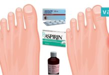 ანალგინი, ასპირინი და იოდი პოდაგრის სამკურნალოდ. სასწაულმოქმედი ნარევია!