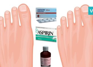 ანალგინი, ასპირინი და იოდი პოდაგრის სამკურნალოდ. სასწაულმოქმედი ნარევია!
