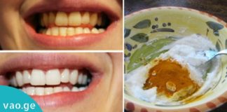 იყავით საკუთარი თავის სტომატოლოგი! გააკეთეთ კბილების მათეთრებელი პასტა სახლში!