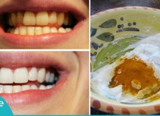 იყავით საკუთარი თავის სტომატოლოგი! გააკეთეთ კბილების მათეთრებელი პასტა სახლში!