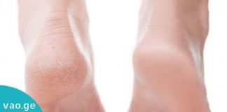 ეს 2 ინგრედიენტი თქვენს ფეხის კანს იდეალურს გახდის – ნუ დახარჯავთ ზედმეტს პედიკიურში