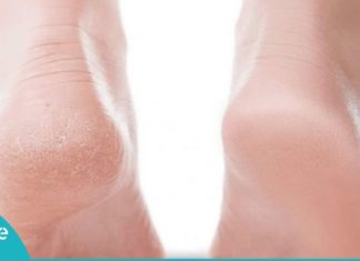 ეს 2 ინგრედიენტი თქვენს ფეხის კანს იდეალურს გახდის – ნუ დახარჯავთ ზედმეტს პედიკიურში