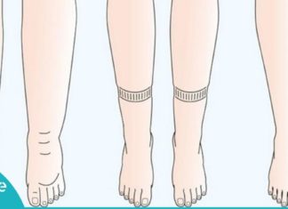 ორგაზნიშმი ზედმეტი სითხის მოსაშორებელი 9 მეთოდი-აირიდეთ შეშუპების პრობლემა!