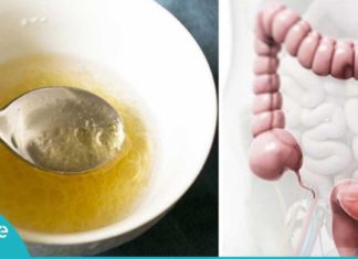 ნაწლავების გასასუფთავებელი ნატურალური საშუალება-ეს უნდა სცადოთ!