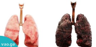 სასმელი, რომელიც ყველა მწეველმა უნდა დალიოს! გადაარჩინეთ ფილტვები