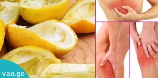 სახსრების ტკივილს და ანთებას ლიმონის ქერქით გაუმკლავდებით. აუცილებლად სცადეთ!