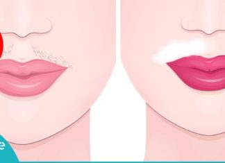 სახლში დამზადებული 10 ბუნებრივი რეცეპტი სახიდან თმის გასაქრობად!