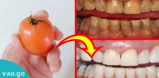 თქვენს კბილებს პომიდორი გაათეთრებს. ნახეთ ეს საოცარი მეთოდი
