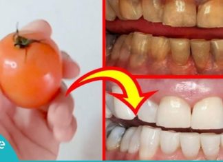 თქვენს კბილებს პომიდორი გაათეთრებს. ნახეთ ეს საოცარი მეთოდი