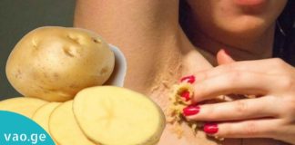 იღლიების გათეთრება უმი კარტოფილის დახმარებით. დაივიწყეთ იღლიის სიშავით გამოწვეული უხერხულობა