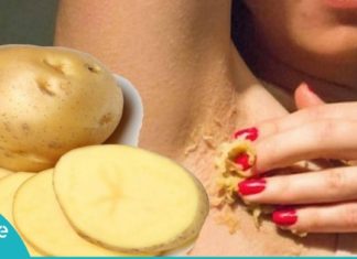 იღლიების გათეთრება უმი კარტოფილის დახმარებით. დაივიწყეთ იღლიის სიშავით გამოწვეული უხერხულობა