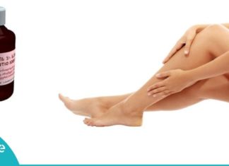 თმის მოშორება იოდის საშუალებით. მხოლოდ რამდენიმე პროცედურა და შედეგი გარანტირებულია