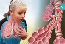 ასთმის და ბრონქიტის მკურნალობის საუკეთესო გზა. ეს რეცეფტი პრობლემას სამუდამოდ დაგავიწყებთ