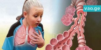 ასთმის და ბრონქიტის მკურნალობის საუკეთესო გზა. ეს რეცეფტი პრობლემას სამუდამოდ დაგავიწყებთ
