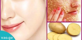 აი რა დაემართება ნაოჭებსა და გამონაყარს თუ კარტოფილს დაიდებთ კანზე!