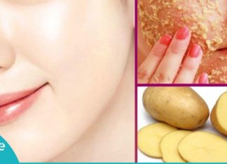 აი რა დაემართება ნაოჭებსა და გამონაყარს თუ კარტოფილს დაიდებთ კანზე!